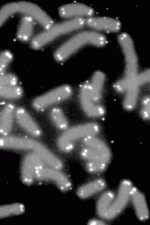 Bright White Dots are Telomere Caps